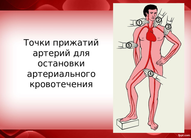 Сколько всего точек прижатия артерий. Точки прижатия артерий для остановки кровотечения. Прижатие подключичной артерии при кровотечении.