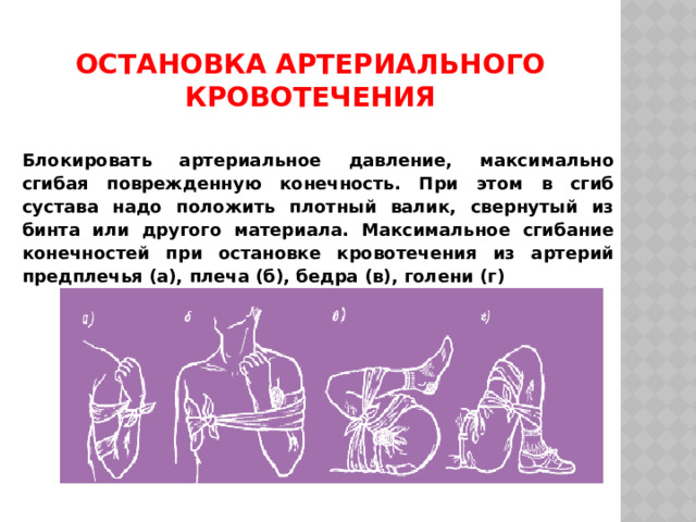 Остановка артериального кровотечения Блокировать артериальное давление, максимально сгибая поврежденную конечность. При этом в сгиб сустава надо положить плотный валик, свернутый из бинта или другого материала. Максимальное сгибание конечностей при остановке кровотечения из артерий предплечья (а), плеча (б), бедра (в), голени (г) 