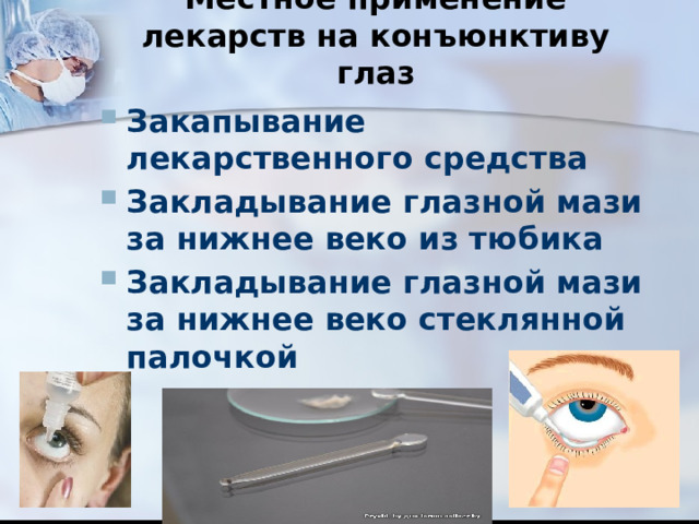 Местное применение лекарств на конъюнктиву глаз   Закапывание лекарственного средства Закладывание глазной мази за нижнее веко из тюбика Закладывание глазной мази за нижнее веко стеклянной палочкой  
