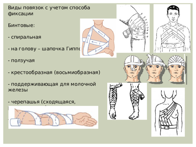 Презентация виды повязок обж