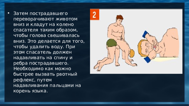 Затем пострадавшего переворачивают животом вниз и кладут на колено спасателя таким образом, чтобы голова свешивалась вниз. Это делается для того, чтобы удалить воду. При этом спасатель должен надавливать на спину и ребра пострадавшего. Необходимо как можно быстрее вызвать рвотный рефлекс, путем надавливания пальцами на корень языка.   