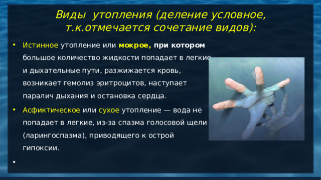 Виды утопления (деление условное, т.к.отмечается сочетание видов): Истинное утопление или мокрое, при котором большое количество жидкости попадает в легкие и дыхательные пути, разжижается кровь, возникает гемолиз эритроцитов, наступает паралич дыхания и остановка сердца. Асфиктическое или сухое утопление — вода не попадает в легкие, из-за спазма голосовой щели (ларингоспазма), приводящего к острой гипоксии. 