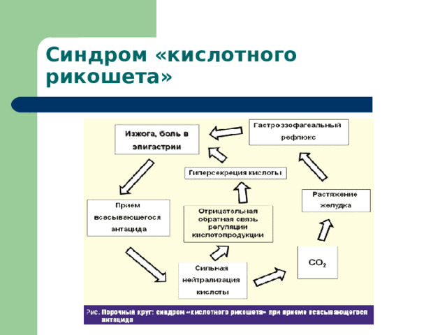 Синдром «кислотного рикошета» 