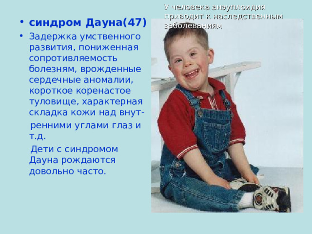 У человека анэуплоидия приводит к наследственным заболеваниям синдром Дауна(47) Задержка умственного развития, пониженная сопротивляемость болезням, врожденные сердечные аномалии, короткое коренастое туловище, характерная складка кожи над внут-  ренними углами глаз и т.д.  Дети с синдромом Дауна рождаются довольно часто. 