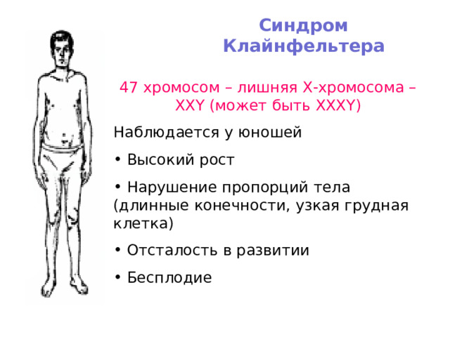 Синдром Клайнфельтера 4 7 хромосом – лишняя Х-хромосома – ХХ Y (может быть ХХХ Y ) Наблюдается у юношей  Высокий рост  Нарушение пропорций тела (длинные конечности, узкая грудная клетка)  Отсталость в развитии  Бесплодие 