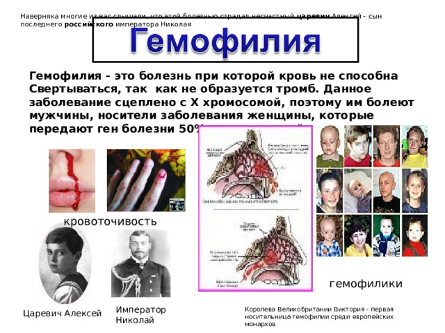 Наверняка многие из вас слышали, что этой болезнью страдал несчастный  царевич  Алексей - сын последнего  российского  императора Николая Гемофилия - это болезнь при которой кровь не способна Свертываться, так как не образуется тромб. Данное заболевание сцеплено с Х хромосомой, поэтому им болеют мужчины, носители заболевания женщины, которые передают ген болезни 50% своих сыновей.  кровоточивость гемофилики Император Николай Королева Великобритании Виктория - первая носительница гемофилии среди европейских монархов Царевич Алексей 