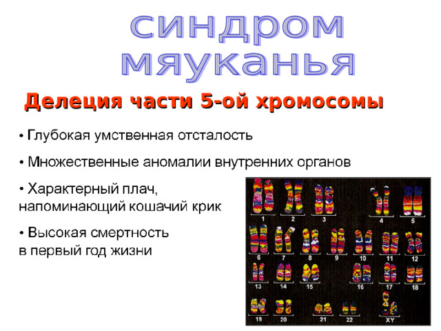 Делеция части 5-ой хромосомы 