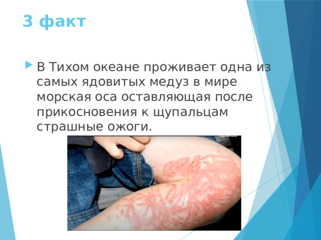 3 факт В Тихом океане проживает одна из самых ядовитых медуз в мире морская оса оставляющая после прикосновения к щупальцам страшные ожоги. 