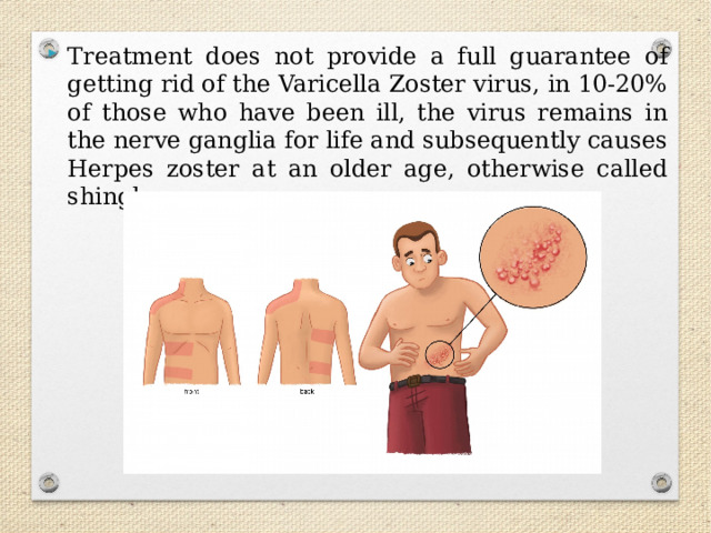 Treatment does not provide a full guarantee of getting rid of the Varicella Zoster virus, in 10-20% of those who have been ill, the virus remains in the nerve ganglia for life and subsequently causes Herpes zoster at an older age, otherwise called shingles. 