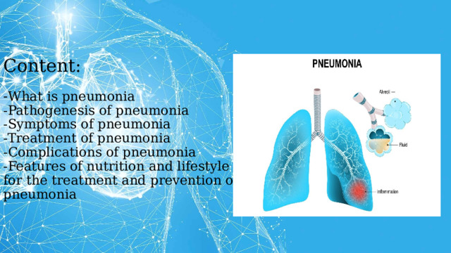 Content:   - What is pneumonia  -Pathogenesis of pneumonia  -Symptoms of pneumonia  -Treatment of pneumonia  -Complications of pneumonia  -Features of nutrition and lifestyle for the treatment and prevention of pneumonia         