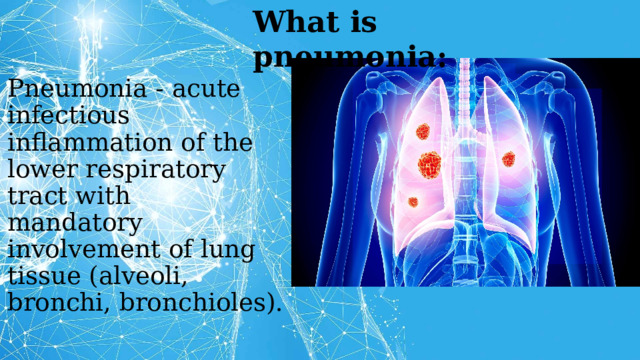 What is pneumonia: Pneumonia - acute infectious inflammation of the lower respiratory tract with  mandatory involvement of lung tissue (alveoli, bronchi, bronchioles).   