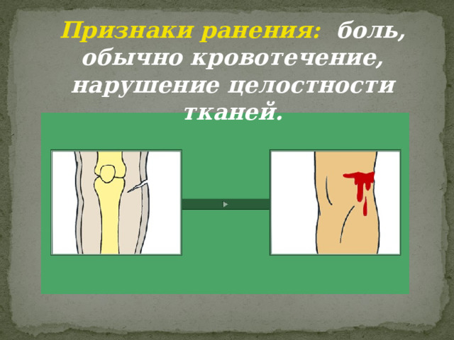 Признаки ранения: боль, обычно кровотечение, нарушение целостности тканей. 