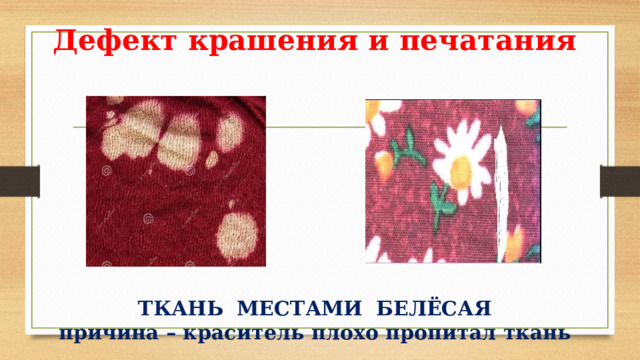 Дефект крашения и печатания            ТКАНЬ МЕСТАМИ БЕЛЁСАЯ  причина – краситель плохо пропитал ткань 