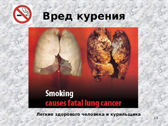 Вред курения Легкие здорового человека и курильщика  