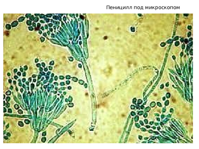 Пеницилл под микроскопом 