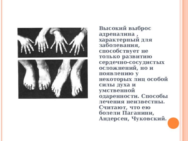 Высокий выброс адреналина , характерный для заболевания, способствует не только развитию сердечно-сосудистых осложнений, но и появлению у некоторых лиц особой силы духа и умственной одаренности. Способы лечения неизвестны. Считают, что ею болели Паганини, Андерсен, Чуковский.  