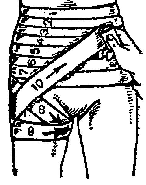 Перевязка ягодицы. Колосовидная повязка на тазобедренный сустав. Колосовидная повязка на бедро. Нисходящая колосовидная повязка на тазобедренный сустав. Техника наложения спиралевидной повязки на живот.