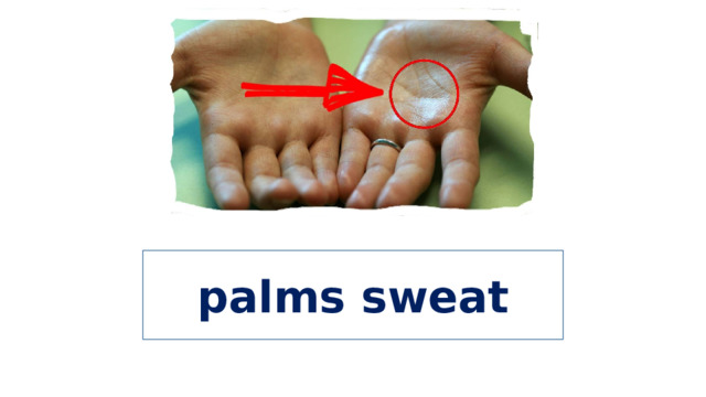 palms sweat 