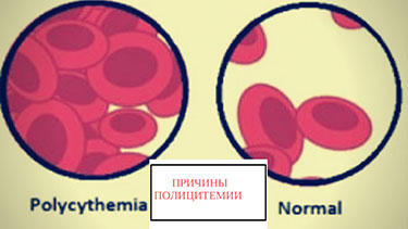 Полицитемия это