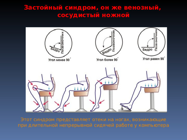 Отеки ног при сидячей работе - normaven.ru