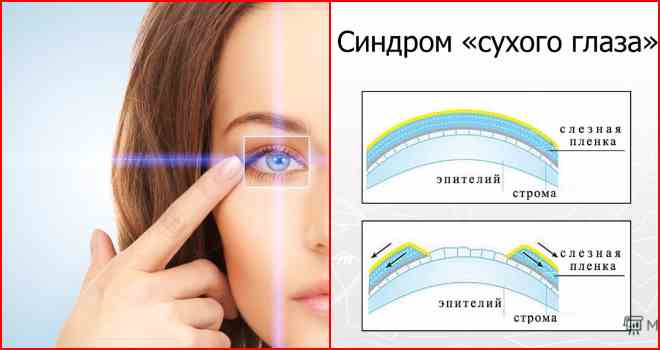 Как выглядит сухой глаз ИССЛЕДОВАТЕЛЬСКАЯ РАБОТА ТЕМА РАБОТЫ "Влияние персонального компьютера на физиче