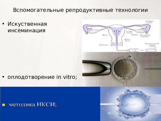 Вспомогательные репродуктивные технологии Искуственная инсеминация      оплодотворение in vitro; 