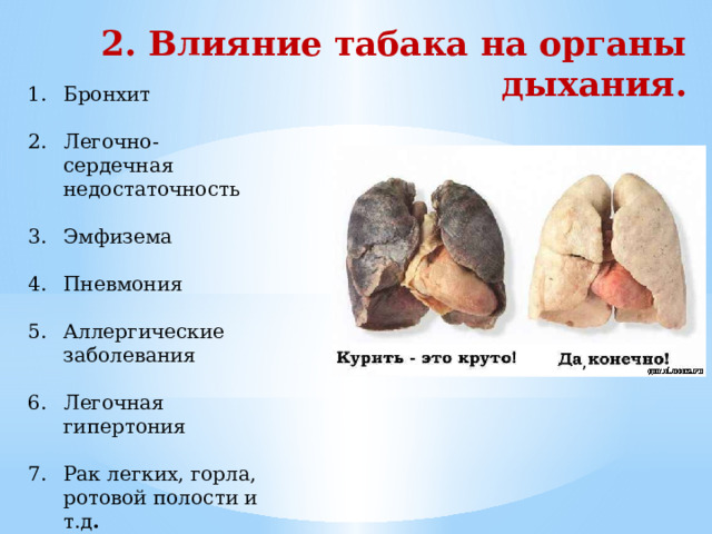 2. Влияние табака на органы дыхания. Бронхит Легочно-сердечная недостаточность Эмфизема Пневмония Аллергические заболевания Легочная гипертония Рак легких, горла, ротовой полости и т.д . 8. Туберкулез  ,  