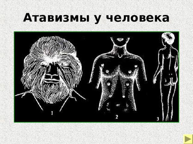 К атавизмам относится. Атавизмы в теле человека. Густой волосяной Покров атавизм.