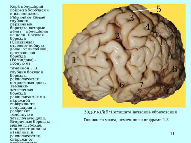 5 Кора полушарий покрыта бороздами и извилинами. Различают самые глубокие первичные борозды, которые делят полушария на доли. Боковая борозда (Сильвиева) отделяет лобную долю от височной, центральная борозда (Роландова) - лобную от теменной . В глубине боковой борозды располагается островковая доля. Теменно-затылочная борозда располагается на наружной поверхности полушария и разделяет теменную и затылочную доли. Вторичные борозды менее глубокие, они делят доли на извилины и располагаются снаружи от одноименных извилин. Третичные (безымянные) борозды придают извилинам индивидуальную форму, увеличивают площадь их коры . . 3 4 2 1 8 6 7 Задача№9 - Напишите название образований Головного мозга, отмеченные цифрами 1-8   