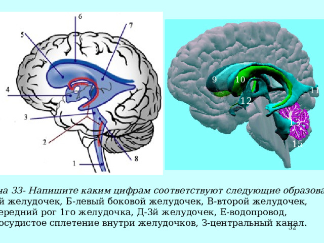  9 10  11   12  13  15 Задача 33- Напишите каким цифрам соответствуют следующие образования :  А-4й желудочек, Б-левый боковой желудочек, В-второй желудочек,  Г-передний рог 1го желудочка, Д-3й желудочек, Е-водопровод,  Ж-сосудистое сплетение внутри желудочков, З-центральный канал.  