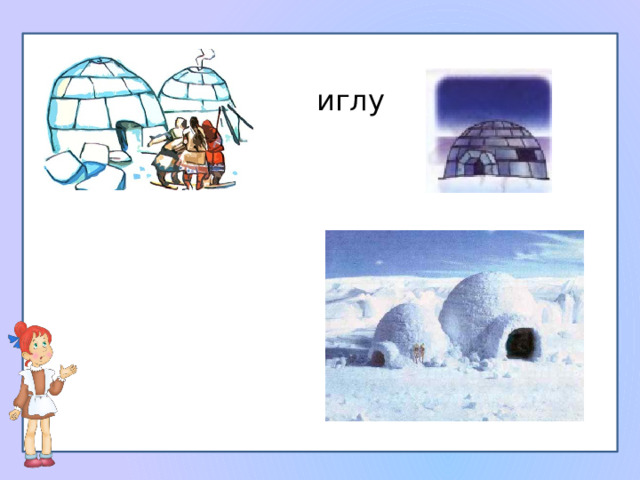 иглу 