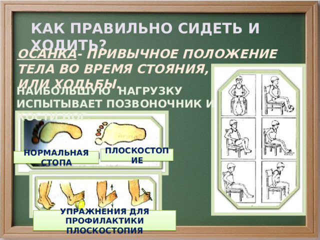 КАК ПРАВИЛЬНО СИДЕТЬ И ХОДИТЬ? ОСАНКА - ПРИВЫЧНОЕ ПОЛОЖЕНИЕ ТЕЛА ВО ВРЕМЯ СТОЯНИЯ, СИДЕНИЯ ИЛИ ХОДЬБЫ. НАИБОЛЬШУЮ НАГРУЗКУ ИСПЫТЫВАЕТ ПОЗВОНОЧНИК И КОСТИ НОГ. ПЛОСКОСТОПИЕ НОРМАЛЬНАЯ СТОПА УПРАЖНЕНИЯ ДЛЯ ПРОФИЛАКТИКИ ПЛОСКОСТОПИЯ 