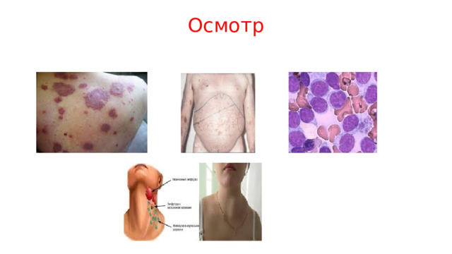 Осмотр 