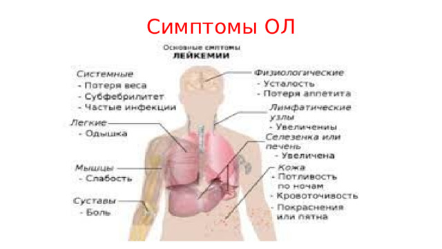 Симптомы ОЛ 
