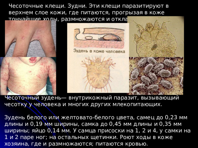 Чесоточные клещи. Зудни. Эти клещи паразитируют в верхнем слое кожи, где питаются, прогрызая в коже тончайшие ходы, размножаются и откладывают яйца. . Чесоточный зудень— внутрикожный паразит, вызывающий чесотку у человека и многих других млекопитающих. Зудень белого или желтовато-белого цвета, самец до 0,23 мм длины и 0,19 мм ширины, самка до 0,45 мм длины и 0,35 мм ширины; яйцо 0,14 мм. У самца присоски на 1, 2 и 4, у самки на 1 и 2 паре ног; на остальных щетинки. Роют ходы в коже хозяина, где и размножаются; питаются кровью. 