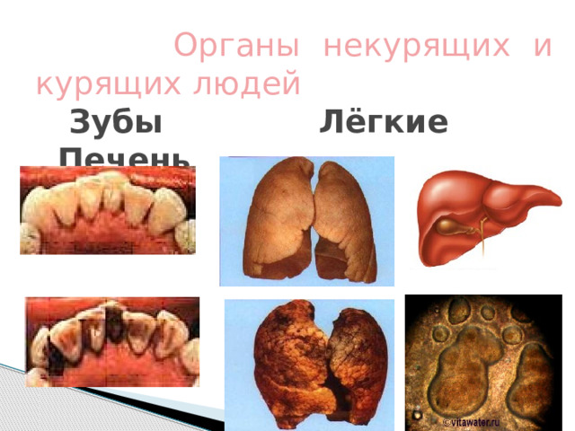  Органы некурящих и курящих людей  Зубы Лёгкие Печень   