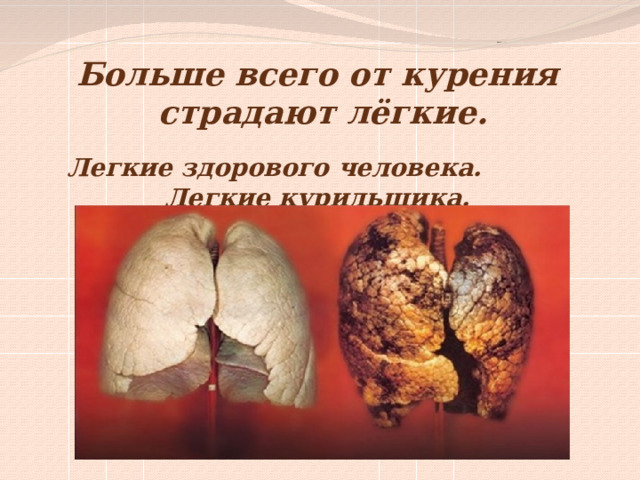 Больше всего от курения  страдают лёгкие.  Легкие здорового человека. Легкие курильщика. 