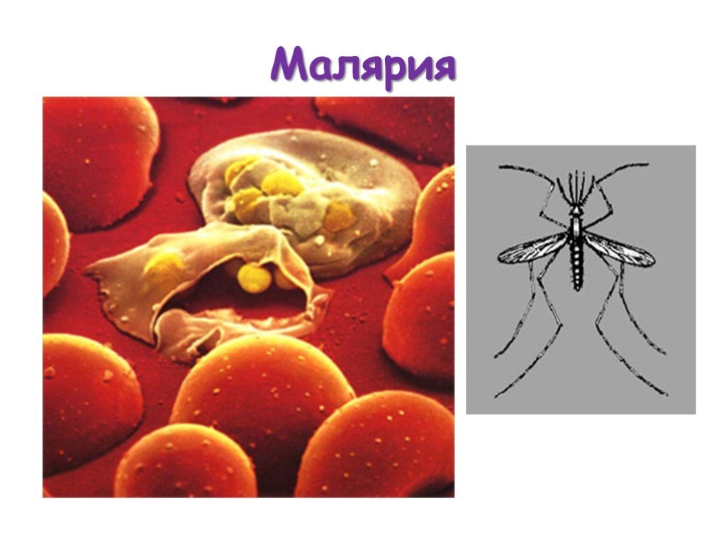 Человек при малярии является