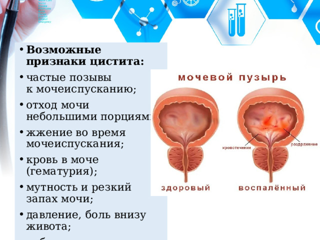 Частые позывы в туалет по большому у женщин причины