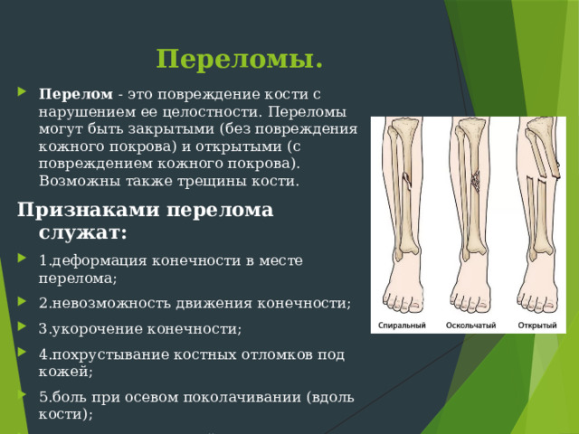 Переломы. Перелом - это повреждение кости с нарушением ее целостности. Переломы могут быть закрытыми (без повреждения кожного покрова) и открытыми (с повреждением кожного покрова). Возможны также трещины кости. Признаками перелома служат: 1.деформация конечности в месте перелома; 2.невозможность движения конечности; 3.укорочение конечности; 4.похрустывание костных отломков под кожей; 5.боль при осевом поколачивании (вдоль кости); 6.при переломе костей таза - невозможность оторвать ногу от поверхности, на которой лежит пациент. 