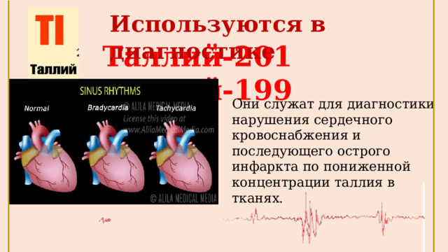 Используются в диагностике Таллий-201  Таллий-199 Они служат для диагностики нарушения сердечного кровоснабжения и последующего острого инфаркта по пониженной концентрации таллия в тканях.  