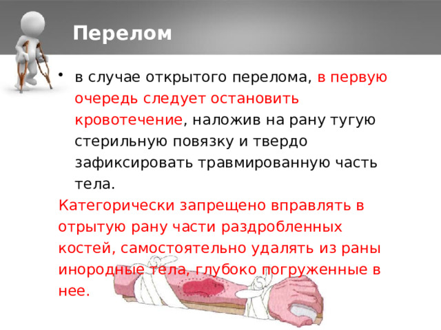 Перелом в случае открытого перелома, в первую очередь следует остановить кровотечение , наложив на рану тугую стерильную повязку и твердо зафиксировать травмированную часть тела. Категорически запрещено вправлять в отрытую рану части раздробленных костей, самостоятельно удалять из раны инородные тела, глубоко погруженные в нее. 1 