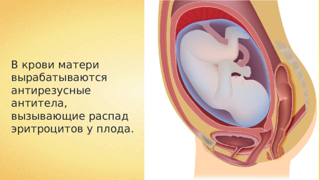 В крови матери вырабатываются антирезусные антитела, вызывающие распад эритроцитов у плода. 