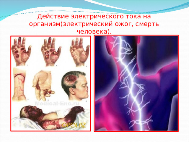 Действие электрического тока на организм(электрический ожог, смерть человека). 