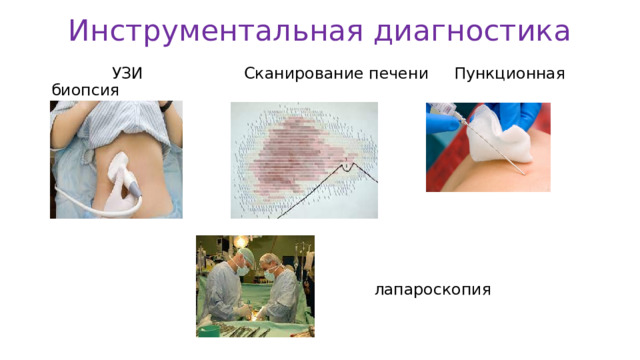 Инструментальная диагностика  УЗИ Сканирование печени Пункционная биопсия  лапароскопия  