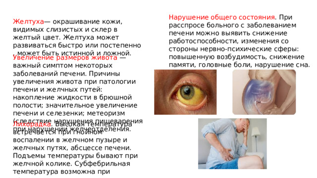 Нарушение общего состояния . При расспросе больного с заболеванием печени можно выявить снижение работоспособности, изменения со стороны нервно-психические сферы: повышенную возбудимость, снижение памяти, головные боли, нарушение сна. Желтуха — окрашивание кожи, видимых слизистых и склер в желтый цвет. Желтуха может развиваться быстро или постепенно , может быть истинной и ложной. Увеличение размеров живота — важный симптом некоторых заболеваний печени. Причины увеличения живота при патологии печени и желчных путей: накопление жидкости в брюшной полости; значительное увеличение печени и селезенки; метеоризм (следствие нарушения пищеварения при нарушении желчеотделения. Лихорадка . Высокая температура встречается при гнойном воспалении в желчном пузыре и желчных путях, абсцессе печени. Подъемы температуры бывают при желчной колике. Субфебрильная температура возможна при хроническом холецистите 