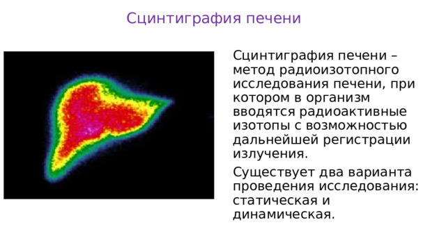 Сцинтиграфия печени Сцинтиграфия печени – метод радиоизотопного исследования печени, при котором в организм вводятся радиоактивные изотопы с возможностью дальнейшей регистрации излучения. Существует два варианта проведения исследования: статическая и динамическая . 