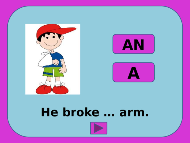 He broke … arm. AN A 