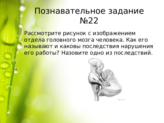 Познавательное задание №22 Рассмотрите рисунок с изображением отдела головного мозга человека. Как его называют и каковы последствия нарушения его работы? Назовите одно из последствий. 