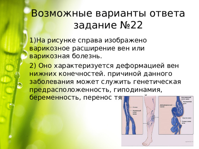 Возможные варианты ответа задание №22 1)На рисунке справа изображено варикозное расширение вен или варикозная болезнь. 2) Оно характеризуется деформацией вен нижних конечностей. причиной данного заболевания может служить генетическая предрасположенность, гиподинамия, беременность, перенос тяжестей и др. 